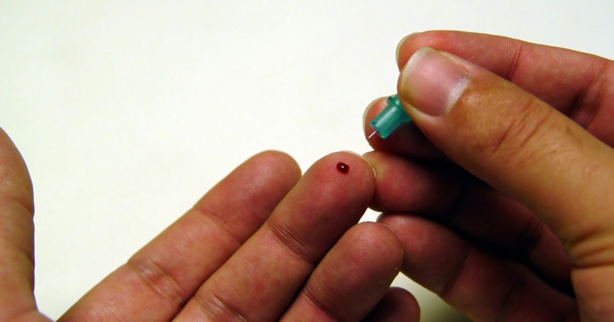 Free HIV tests made available in England G&L Healthcare